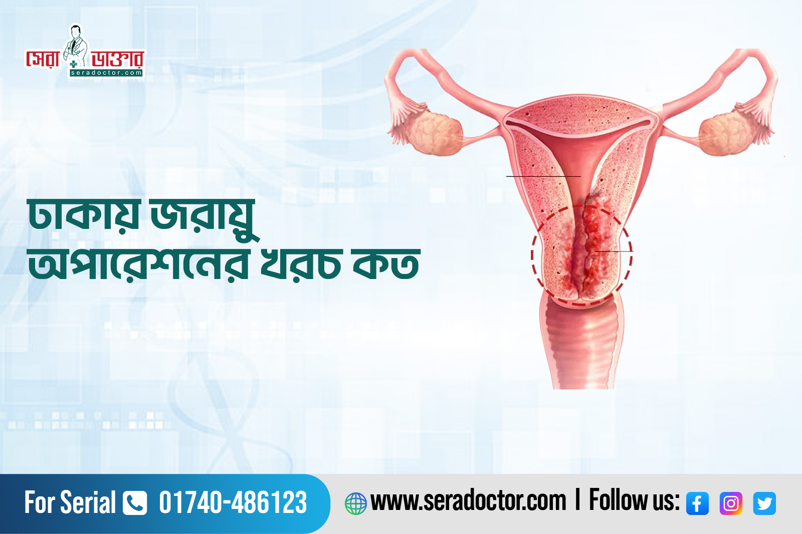 ঢাকায় জরায়ু অপারেশনের খরচ কত 